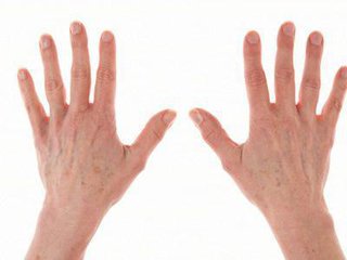 哪些老年性疾病是由于前列